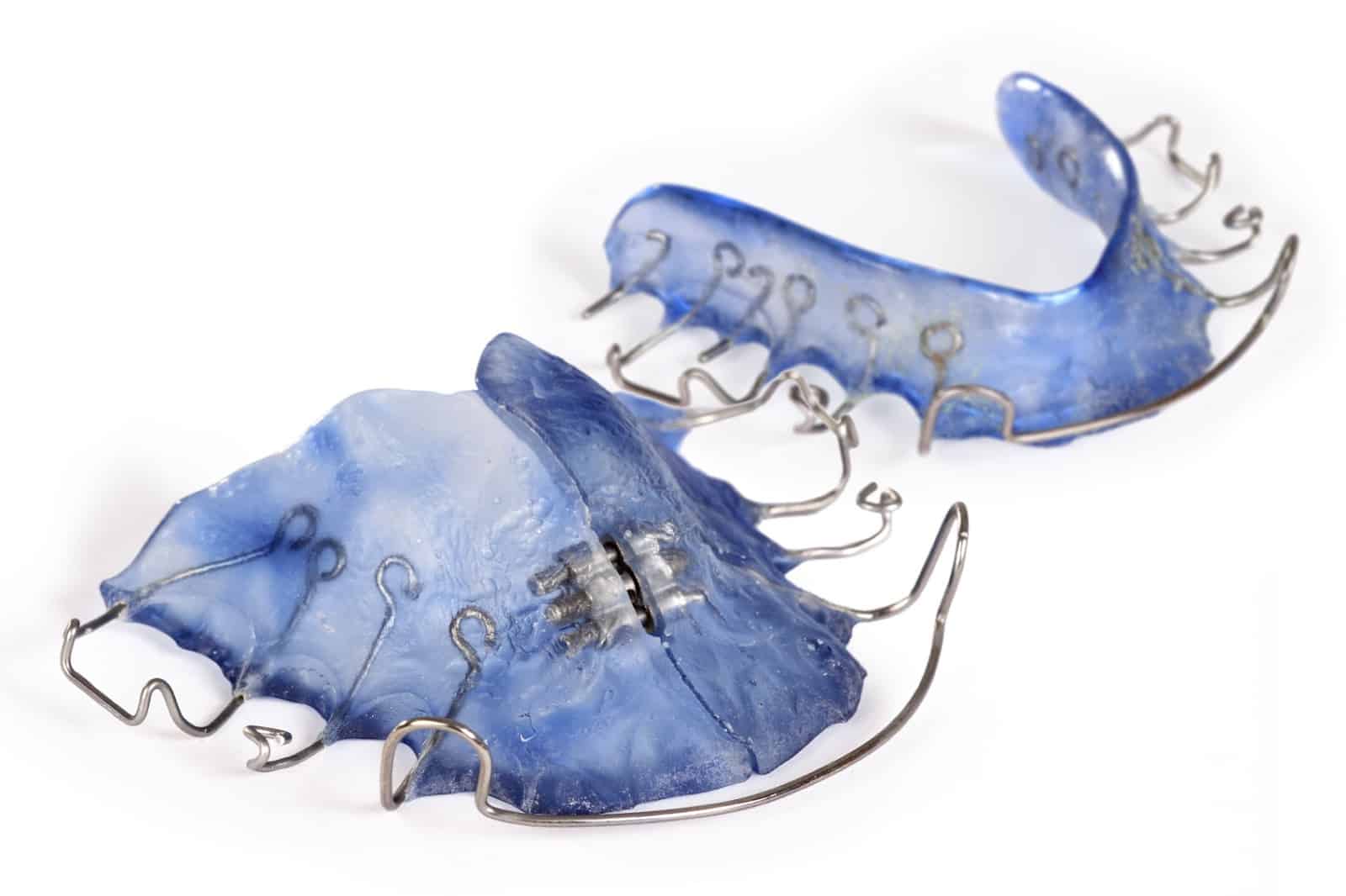 upper and lower blue acrylic retainers