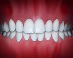 common dental problems