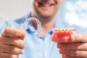 Dental,Care.smiling,Dentist,Doctor,Holding,Aligners,And,Braces,In,Hand